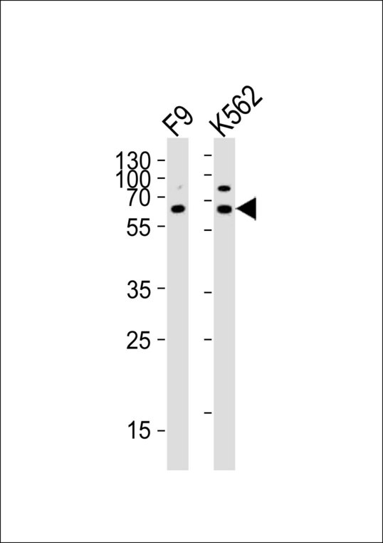 ASH2L / ASH2 Antibody - Western blot of lysates from mouse F9, human K562 cell line (from left to right) with ASH2L Antibody. Antibody was diluted at 1:1000 at each lane. A goat anti-rabbit IgG H&L (HRP) at 1:10000 dilution was used as the secondary antibody. Lysates at 20 ug per lane.
