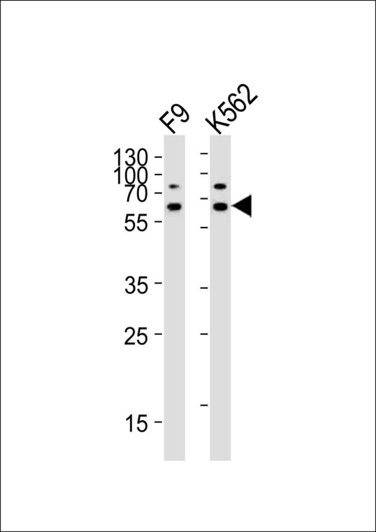 ASH2L / ASH2 Antibody - Western blot of lysates from mouse F9, human K562 cell line (from left to right) with ASH2L Antibody. Antibody was diluted at 1:1000 at each lane. A goat anti-rabbit IgG H&L (HRP) at 1:10000 dilution was used as the secondary antibody. Lysates at 20 ug per lane.