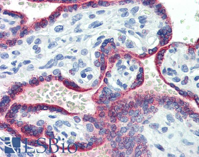 ASH2L / ASH2 Antibody - Anti-ASH2L antibody IHC of human placenta. Immunohistochemistry of formalin-fixed, paraffin-embedded tissue after heat-induced antigen retrieval. Antibody concentration 5 ug/ml.  This image was taken for the unconjugated form of this product. Other forms have not been tested.