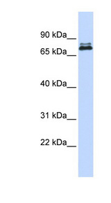 ASH2L / ASH2 Antibody - ASH2L antibody Western blot of HeLa lysate. This image was taken for the unconjugated form of this product. Other forms have not been tested.