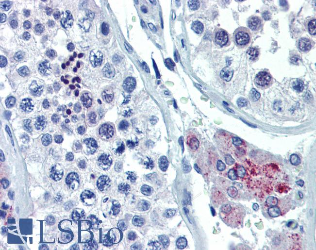 ASH2L / ASH2 Antibody - Anti-ASH2L antibody IHC of human testis. Immunohistochemistry of formalin-fixed, paraffin-embedded tissue after heat-induced antigen retrieval. Antibody concentration 5 ug/ml.  This image was taken for the unconjugated form of this product. Other forms have not been tested.