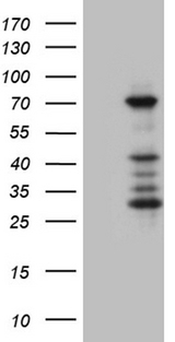 ASH2L / ASH2 Antibody - HEK293T cells were transfected with the pCMV6-ENTRY control. (Left lane) or pCMV6-ENTRY ASH2L. (Right lane) cDNA for 48 hrs and lysed