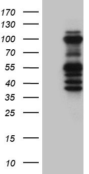 ASH2L / ASH2 Antibody - HEK293T cells were transfected with the pCMV6-ENTRY control. (Left lane) or pCMV6-ENTRY ASH2L. (Right lane) cDNA for 48 hrs and lysed. Equivalent amounts of cell lysates. (5 ug per lane) were separated by SDS-PAGE and immunoblotted with anti-ASH2L. (1:2000)
