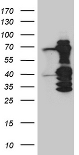 ASH2L / ASH2 Antibody - HEK293T cells were transfected with the pCMV6-ENTRY control. (Left lane) or pCMV6-ENTRY ASH2L. (Right lane) cDNA for 48 hrs and lysed. Equivalent amounts of cell lysates. (5 ug per lane) were separated by SDS-PAGE and immunoblotted with anti-ASH2L. (1:2000)