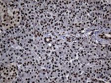 ASH2L / ASH2 Antibody - Immunohistochemical staining of paraffin-embedded Human pancreas tissue within the normal limits using anti-ASH2L mouse monoclonal antibody. (Heat-induced epitope retrieval by 1mM EDTA in 10mM Tris buffer. (pH8.5) at 120°C for 3 min. (1:2000)