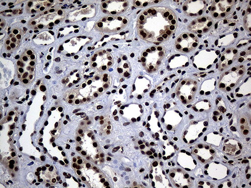 ASH2L / ASH2 Antibody - Immunohistochemical staining of paraffin-embedded Human Kidney tissue within the normal limits using anti-ASH2L mouse monoclonal antibody. (Heat-induced epitope retrieval by 1mM EDTA in 10mM Tris buffer. (pH8.5) at 120°C for 3 min. (1:2000)