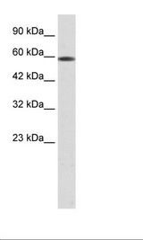 ASH2L / ASH2 Antibody - Jurkat Cell Lysate.  This image was taken for the unconjugated form of this product. Other forms have not been tested.