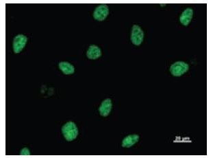 ASH2L / ASH2 Antibody - Immunofluorescent staining using ASH2L antibody. Immunostaining analysis in HeLa cells. HeLa cells were fixed with 4% paraformaldehyde and permeabilized with 0.01% Triton-X100 in PBS. The cells were immunostained with anti-ASH2L antibody.