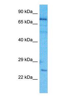 ASH2L / ASH2 Antibody - Western blot of ASH2L Antibody with human HepG2 Whole Cell lysate.  This image was taken for the unconjugated form of this product. Other forms have not been tested.