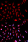 ASH2L / ASH2 Antibody - Immunofluorescence analysis of U20S cells.