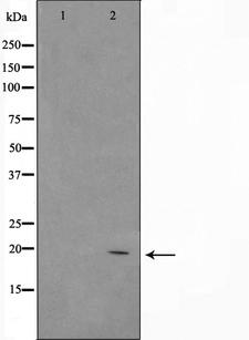 ASH2L / ASH2 Antibody - Western blot analysis of ASH2 using 293 whole cells lysates