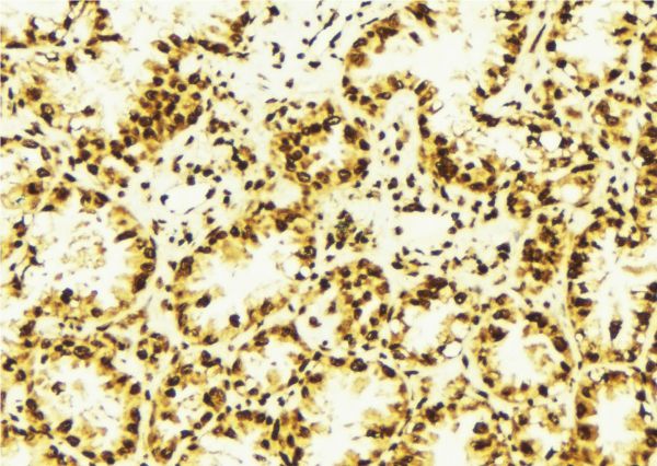 ASH2L / ASH2 Antibody - 1:100 staining human lung tissue by IHC-P. The sample was formaldehyde fixed and a heat mediated antigen retrieval step in citrate buffer was performed. The sample was then blocked and incubated with the antibody for 1.5 hours at 22°C. An HRP conjugated goat anti-rabbit antibody was used as the secondary.