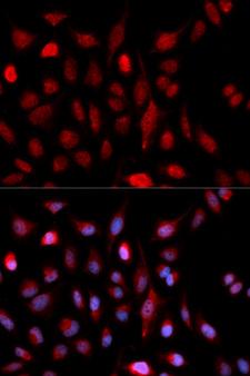 ASH2L / ASH2 Antibody - Immunofluorescence analysis of U2OS cells using ASH2L Polyclonal Antibody.