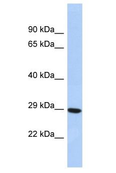 ASIC1 / ACCN2 Antibody - ACCN2 / ASIC antibody Western Blot of 721_B. Antibody dilution: 1 ug/ml.  This image was taken for the unconjugated form of this product. Other forms have not been tested.
