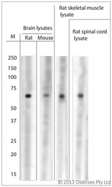 ASIC1 / ACCN2 Antibody - Rabbit antibody to ASIC1 (460-505). WB on rat/mouse tissue lysates. Blocking: 0.5% LFDM for one hour at RT, primary antibody dilution 1:1000 incubated overnight at 4C. Detection was done by C-Digit from LiCor.