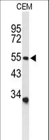 ASIC1 / ACCN2 Antibody - Western blot of ACCN2 Antibody in CEM cell line lysates (35 ug/lane). ACCN2 (arrow) was detected using the purified antibody.