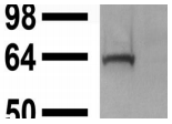 ASIC1 / ACCN2 Antibody - A band of ~60kDa is detected.