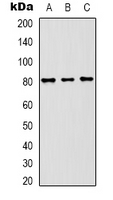 ASIC1 / ACCN2 Antibody - Western blot analysis of ASIC1 expression in 293T (A); mouse brain (B); rat brain (C) whole cell lysates.