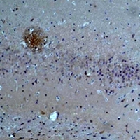 ASIC1 / ACCN2 Antibody - Immunohistochemical analysis of ASIC1 staining in rat brain formalin fixed paraffin embedded tissue section. The section was pre-treated using heat mediated antigen retrieval with sodium citrate buffer (pH 6.0). The section was then incubated with the antibody at room temperature and detected using an HRP conjugated compact polymer system. DAB was used as the chromogen. The section was then counterstained with hematoxylin and mounted with DPX.