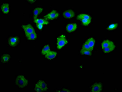 ASIC1 / ACCN2 Antibody - Immunofluorescence staining of HepG2 cells diluted at 1:133, counter-stained with DAPI. The cells were fixed in 4% formaldehyde, permeabilized using 0.2% Triton X-100 and blocked in 10% normal Goat Serum. The cells were then incubated with the antibody overnight at 4°C.The Secondary antibody was Alexa Fluor 488-congugated AffiniPure Goat Anti-Rabbit IgG (H+L).