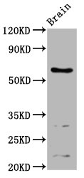 ASIC1 / ACCN2 Antibody - Western Blot Positive WB detected in: Mouse brain tissue All Lanes: ASIC1 antibody at 4.24µg/ml Secondary Goat polyclonal to rabbit IgG at 1/50000 dilution Predicted band size: 60, 65, 63 KDa Observed band size: 60 KDa