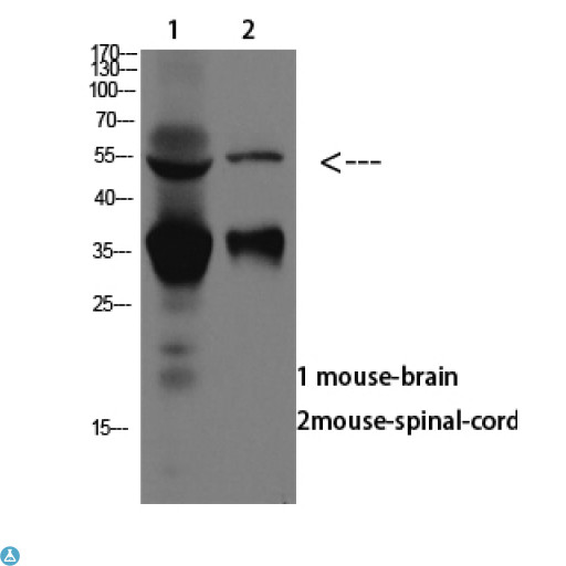 ASIC1 / ACCN2 Antibody - Western blot analysis of mouse brain and mouse spinal cord lysate, antibody was diluted at 1000. Secondary antibody was diluted at 1:20000.