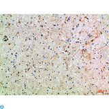 ASIC1 / ACCN2 Antibody - Immunohistochemical analysis of paraffin-embedded Human-brain, antibody was diluted at 1:100.