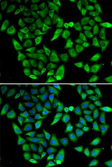 ASIP Antibody - Immunofluorescence analysis of HeLa cells.