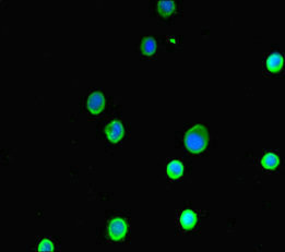 ASIP Antibody - Immunofluorescent analysis of MCF7 cells diluted at 1:100 and Alexa Fluor 488-congugated AffiniPure Goat Anti-Rabbit IgG(H+L)