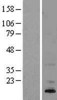 ASIP Protein - Western validation with an anti-DDK antibody * L: Control HEK293 lysate R: Over-expression lysate