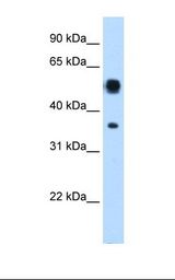 ASL / Argininosuccinate Lyase Antibody - Transfected 293T cell lysate. Antibody concentration: 0.25 ug/ml. Gel concentration: 12%.  This image was taken for the unconjugated form of this product. Other forms have not been tested.