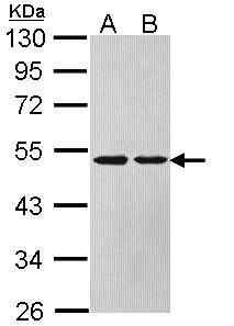 ASL / Argininosuccinate Lyase Antibody - Sample (30 ug of whole cell lysate). A: HeLa, B: Hep G2 . 10% SDS PAGE. Arginosuccinate Lyase / ASL antibody diluted at 1:1000.