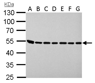 ASL / Argininosuccinate Lyase Antibody - ASL antibody detects ASL protein by Western blot analysis. A. 30 ug Neuro2A whole lysate/extract. B. 30 ug GL261 whole cell lysate/extract. C. 30 ug C8D30 whole cell lysate/extract. D. 30 ug NIH-3T3 whole cell lysate/extract. E. 30 ug BCL-1 whole cell lysate/extract. F. 30 ug Raw264.7 whole cell lysate/extract. G. 30 ug C2C12 whole cell lysate/extract. 10 % SDS-PAGE. ASL antibody dilution:1:1000