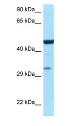 ASL / Argininosuccinate Lyase Antibody - Arginosuccinate Lyase / ASL antibody Western Blot of Mouse Liver.  This image was taken for the unconjugated form of this product. Other forms have not been tested.