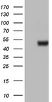 ASL / Argininosuccinate Lyase Antibody - HEK293T cells were transfected with the pCMV6-ENTRY control. (Left lane) or pCMV6-ENTRY ASL. (Right lane) cDNA for 48 hrs and lysed. Equivalent amounts of cell lysates. (5 ug per lane) were separated by SDS-PAGE and immunoblotted with anti-ASL.