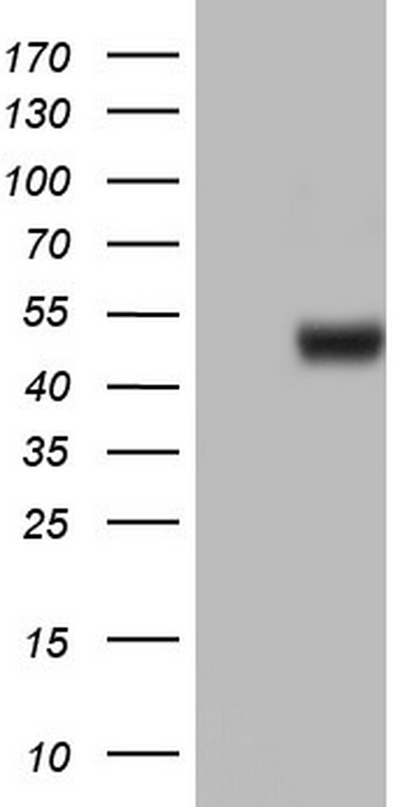 ASL / Argininosuccinate Lyase Antibody - HEK293T cells were transfected with the pCMV6-ENTRY control (Left lane) or pCMV6-ENTRY ASL (Right lane) cDNA for 48 hrs and lysed. Equivalent amounts of cell lysates (5 ug per lane) were separated by SDS-PAGE and immunoblotted with anti-ASL.