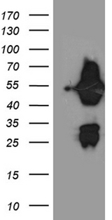 ASL / Argininosuccinate Lyase Antibody - HEK293T cells were transfected with the pCMV6-ENTRY control. (Left lane) or pCMV6-ENTRY ASL. (Right lane) cDNA for 48 hrs and lysed. Equivalent amounts of cell lysates. (5 ug per lane) were separated by SDS-PAGE and immunoblotted with anti-ASL. (1:2000)