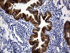 ASL / Argininosuccinate Lyase Antibody - Immunohistochemical staining of paraffin-embedded Human endometrium tissue within the normal limits using anti-ASL mouse monoclonal antibody. (Heat-induced epitope retrieval by 1mM EDTA in 10mM Tris buffer. (pH8.5) at 120°C for 3 min. (1:500)