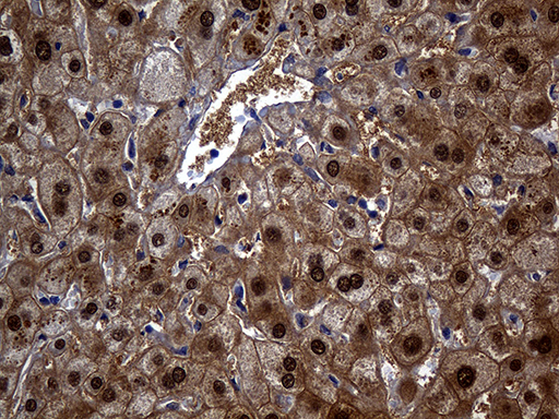 ASL / Argininosuccinate Lyase Antibody - Immunohistochemical staining of paraffin-embedded Human liver tissue within the normal limits using anti-ASL mouse monoclonal antibody. (Heat-induced epitope retrieval by 1mM EDTA in 10mM Tris buffer. (pH8.5) at 120°C for 3 min. (1:500)