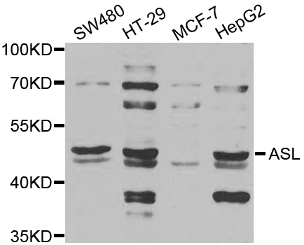 ASL / Argininosuccinate Lyase Antibody - Western blot analysis of extracts of various cell lines.