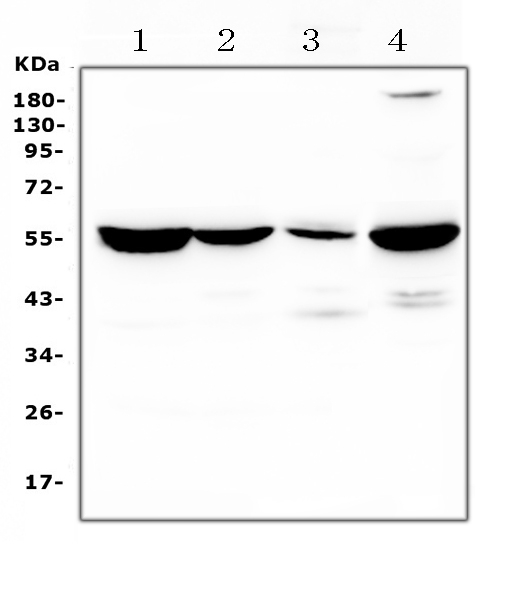 ASL / Argininosuccinate Lyase Antibody - Western blot analysis of Adenylosuccinate Lyase using anti-Adenylosuccinate Lyase antibody. Electrophoresis was performed on a 5-20% SDS-PAGE gel at 70V (Stacking gel) / 90V (Resolving gel) for 2-3 hours. The sample well of each lane was loaded with 50ug of sample under reducing conditions. Lane 1: rat liver tissue lysates,Lane 2: rat kidney tissue lysates,Lane 3: rat lung tissue lysates,Lane 4: mouse liver tissue lysates. After Electrophoresis, proteins were transferred to a Nitrocellulose membrane at 150mA for 50-90 minutes. Blocked the membrane with 5% Non-fat Milk/ TBS for 1.5 hour at RT. The membrane was incubated with rabbit anti-Adenylosuccinate Lyase antigen affinity purified polyclonal antibody at 0.5 ug/mL overnight at 4?, then washed with TBS-0.1% Tween 3 times with 5 minutes each and probed with a goat anti-rabbit IgG-HRP secondary antibody at a dilution of 1:10000 for 1.5 hour at RT. The signal is developed using an Enhanced Chemiluminescent detection (ECL) kit with Tanon 5200 system. A specific band was detected for Adenylosuccinate Lyase at approximately 52KD. The expected band size for Adenylosuccinate Lyase is at 52KD.