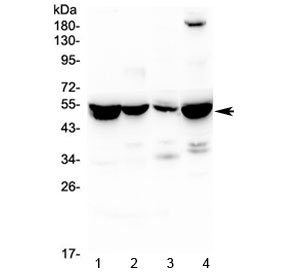 ASL / Argininosuccinate Lyase Antibody - Western blot testing of 1) rat liver, 2) rat kidney, 3) rat lung and 4) mouse liver lysate with ASL antibody at 0.5ug/ml. Predicted molecular weight ~52 kDa.