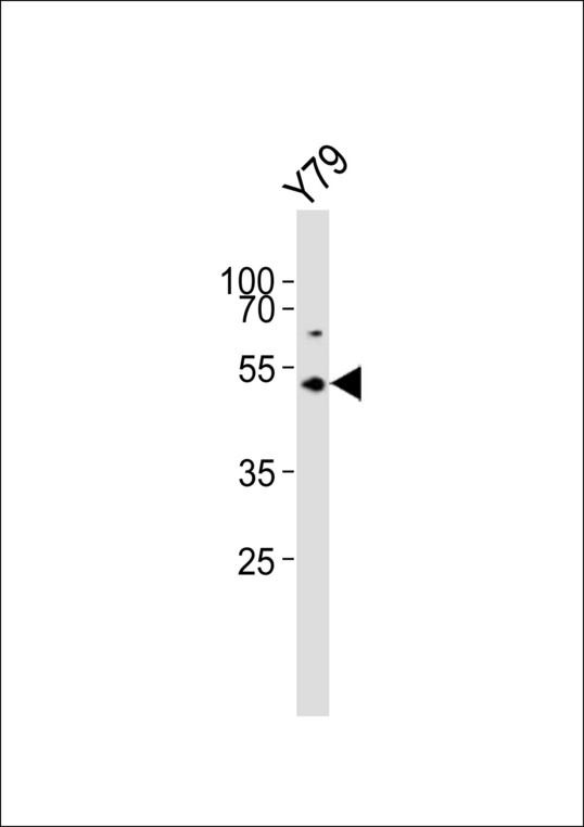 ASMT / HIOMT Antibody - Western blot of lysate from Y79 cell line, using ASMT Antibody. Antibody was diluted at 1:1000. A goat anti-rabbit IgG H&L (HRP) at 1:10000 dilution was used as the secondary antibody. Lysate at 20ug.