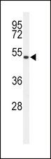 ASMT / HIOMT Antibody - Western blot of ASMT Antibody in 293 cell line lysates (35 ug/lane). ASMT (arrow) was detected using the purified antibody.