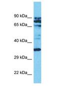 ASMT / HIOMT Antibody - ASMT / HIOMT antibody Western Blot of Jurkat. Antibody dilution: 1 ug/ml.  This image was taken for the unconjugated form of this product. Other forms have not been tested.