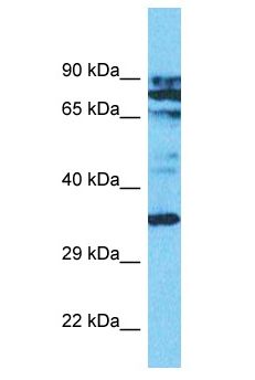 ASMT / HIOMT Antibody - ASMT / HIOMT antibody Western Blot of Jurkat. Antibody dilution: 1 ug/ml.  This image was taken for the unconjugated form of this product. Other forms have not been tested.