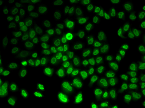 ASMT / HIOMT Antibody - Immunofluorescence analysis of HeLa cell using ASMT antibody.