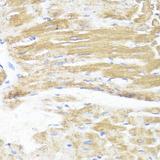 ASMT / HIOMT Antibody - Immunohistochemistry of paraffin-embedded Rat heart using ASMT Polyclonal Antibody at dilution of 1:100 (40x lens).