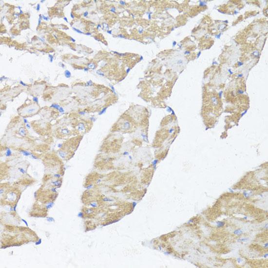 ASMT / HIOMT Antibody - Immunohistochemistry of paraffin-embedded Mouse heart using ASMT Polyclonal Antibody at dilution of 1:100 (40x lens).