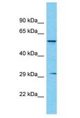 ASMT / HIOMT Antibody - ASMT / HIOMT antibody Western Blot of Fetal Kidney. Antibody dilution: 1 ug/ml.  This image was taken for the unconjugated form of this product. Other forms have not been tested.